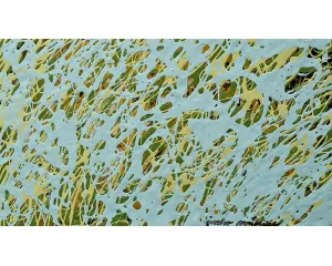 Poválečné umění